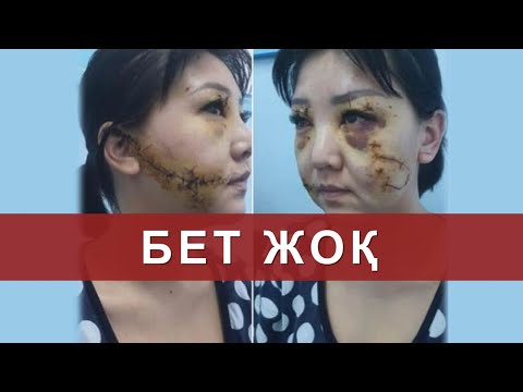 Видео: Күйеуімнің кесірі (Айнагүл Бекенованы ұрып, бетін тілгілеп тастаған): Астарлы ақиқат