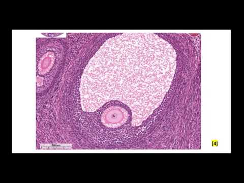 Видео: ЖПС. Особенности овогенеза. Препарат яичник и фолликулогенез. Стадии развития желтого тела.