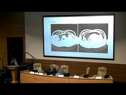 Видео: Технологии экстракорпоральной мембранной оксигенации в многопрофильной клинике