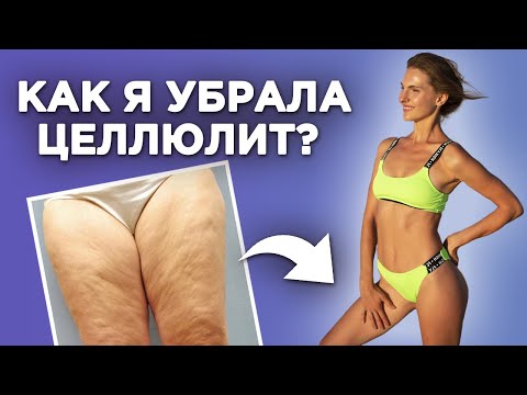 Видео: Что делать, если появился целлюлит на внутренней поверхности бедра? | Как привести бедра в тонус?