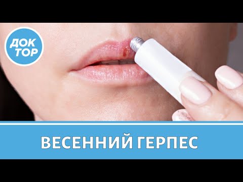 Видео: Герпес: как быстро и эффективно избавиться от простуды на губах