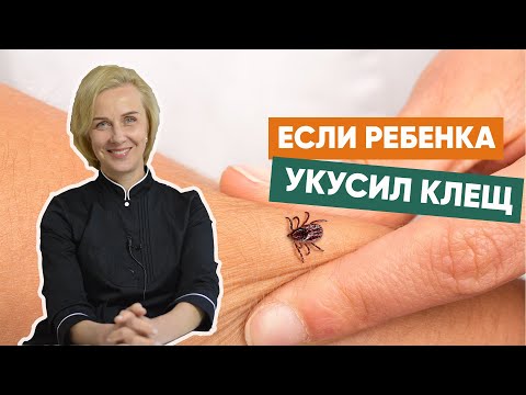 Видео: Если ребенка укусил клещ