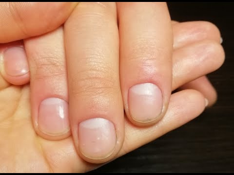 Видео: Чоловічий гігієнічний манікюр/ потріскана кутикула/ перетворення чистоти