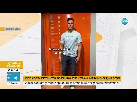 Видео: Чупене на кости и нечовешка болка: Разказ на мъжа, който удължи ръста си оперативно