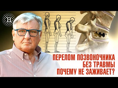 Видео: ПЕРЕЛОМ ПОЗВОНОЧНИКА БЕЗ ТРАВМЫ.ПОЧЕМУ НЕ ЗАЖИВАЕТ?