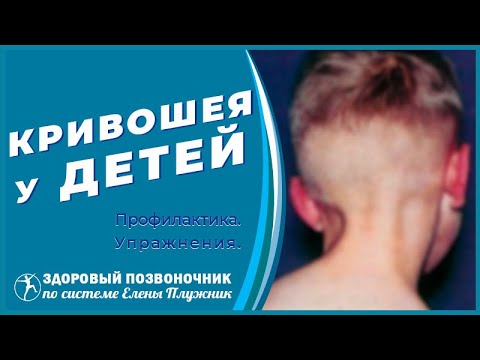 Видео: Кривошея у детей. Хруст и боль в шее. Профилактика. Упражнения. Методика Елены Плужник.