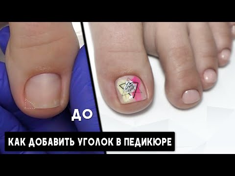 Видео: Как доставить уголок в педикюре ✅Ремонт уголка ногтя полигелем ✅ Экспресс дизайн со слайдером