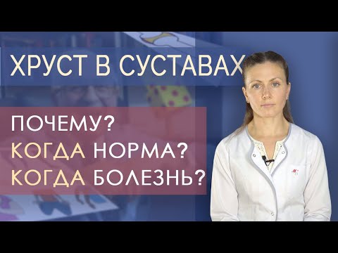 Видео: Хруст в суставах. Почему хрустят суставы?  Всегда ли это проблема? Что делать?