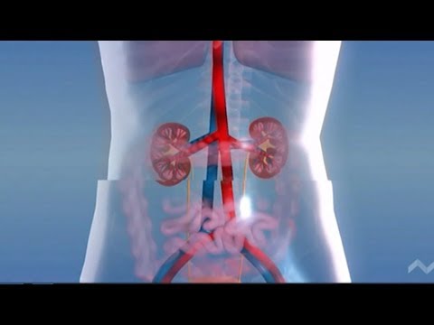 Видео: Диабетна нефропатия - причини, ранна диагностика и лечение
