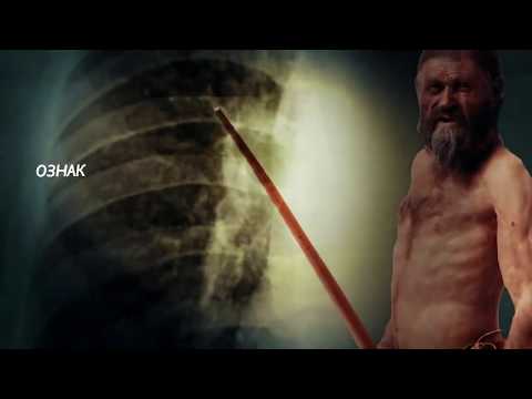 Видео: фільм про туберкульоз