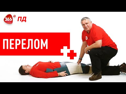 Видео: Переломи та інші Травми Кінцівок | Перша Допомога