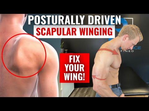 Видео: Как исправить крыловидные лопатки