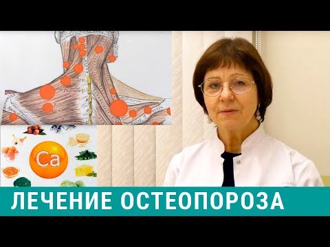 Видео: Остеопороз - что это? Симптомы и лечение остеопороза. Нутрицевтики