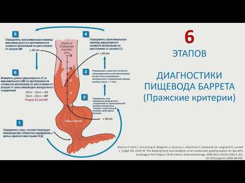 Видео: Стандарты диагностики предопухолевый патологии и раннего рака пищевода. Новые рекомендации ВОЭ
