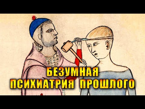 Видео: Дырка в черепе, компресс из мозгов, утопление. Как раньше лечила психиатрия