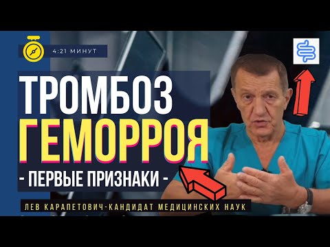 Видео: ТРОМБОЗ ГЕМОРРОЯ - Что поможет ПРИ ПЕРВЫХ ПРИЗНАКАХ и если нет возможности попасть к врачу