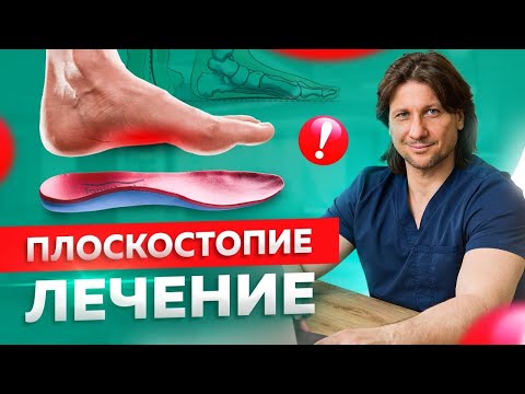 Видео: Плоскостопие – ну и что? Диагностика и лечение плоскостопия