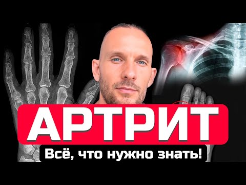 Видео: Я просто хотел ответить на голосовое сообщение, что такое ревматоидный артрит