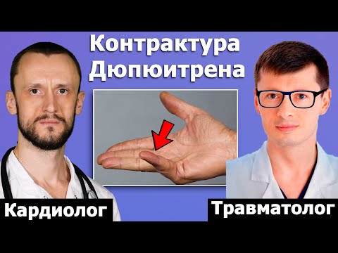 Видео: Контрактура Дюпюитрена ⚡ Лечение за 30 минут ⚡ 100% результат