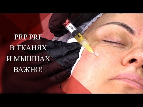 Видео: 💉PRP и PRF в тканях и мышцах | ЧТО ВАЖНО ЗНАТЬ!