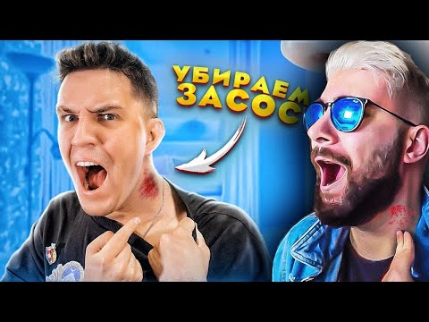 Видео: Убираем ЗАСОС на ШЕЕ! Самый СЕКРЕТНЫЙ ЛАЙФХАК из Тик-Ток! ПРОВЕРКА ► Дима Масленников | Реакция