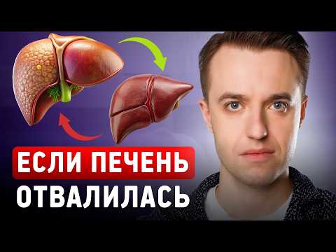 Видео: Если печень отвалилась. Забота о печени – ключ к здоровью организма!