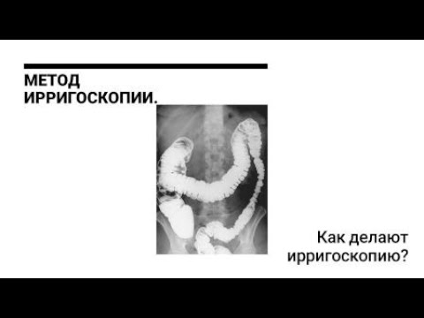 Видео: Метод ИРРИГОСКОПИИ / Как делают Ирригоскопию?