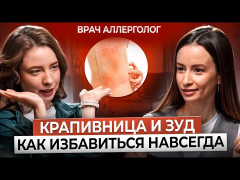 Видео: Крапивница. Причины. Симптомы. Лечение. Как избавиться от зуда и крапивницы навсегда