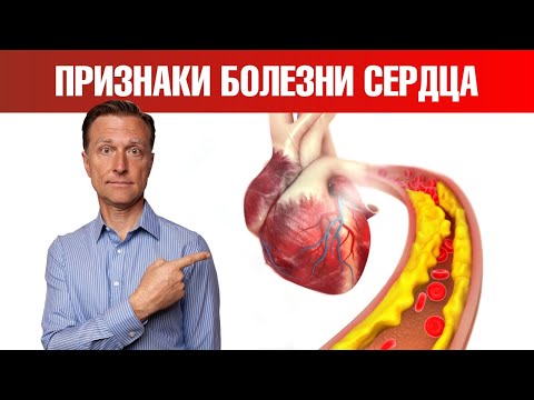Видео: Необычные признаки болезни сердца, о которых вы должны знать📢