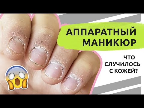 Видео: Что СЛУЧИЛОСЬ с кожей? Аппаратный маникюр