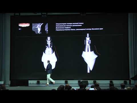 Видео: Конгресс ITI 2018, 12-13 октября, Сочи. Выступление Гамида Насуева.