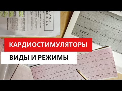 Видео: Кардиостимуляторы. Виды и режимы работы кардиостимуляторов.