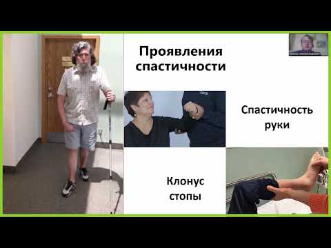 Видео: Шмонин А.А. Спастичность и ботулинотерапия: что нужно знать для родителей