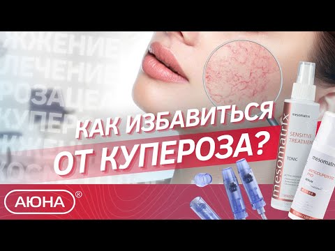 Видео: ФРАКЦИОННАЯ МЕЗОТЕРАПИЯ: особенности работы с чувствительной кожей. СОСТАВ мезококтейля и КУРС
