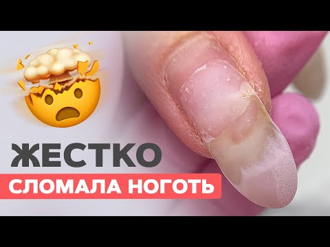 Видео: Фатальные ошибки при укреплении | Клюющие ногти