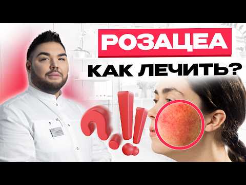Видео: ПОЧЕМУ ПОЯВЛЯЕТСЯ РОЗАЦЕА И КАК С НЕЙ БОРОТЬСЯ? Симптомы и лечение розацеа