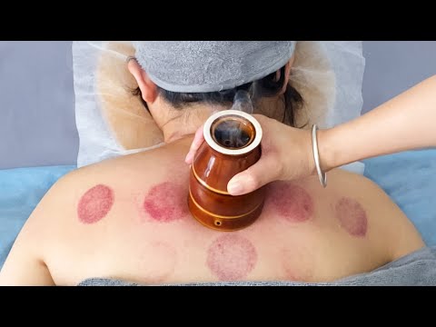 Видео: ASMR Самый профессиональный массаж шеи и плеч