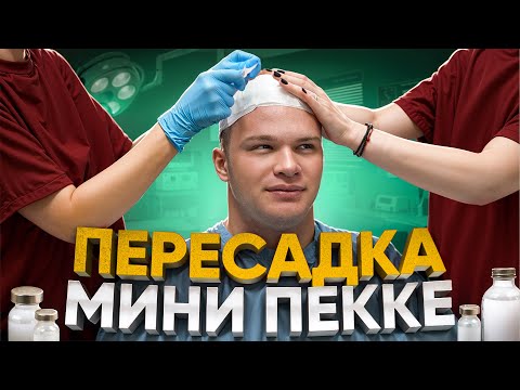 Видео: ПЕРЕСАДКА ВОЛОС МИНИ ПЕККЕ