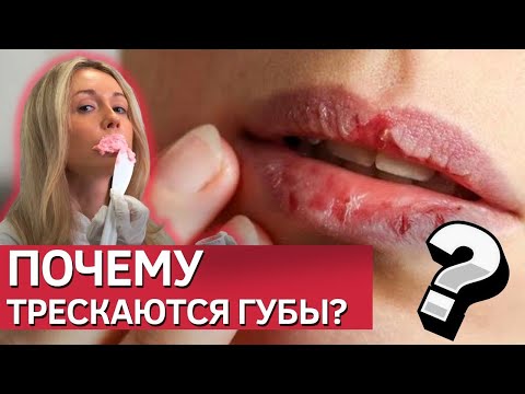 Видео: Что делать с сухостью и шелушением губ | 2 простых варианта экспресс ухода | Советы косметолога