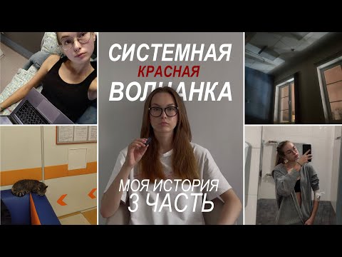 Видео: Системная красная волчанка|моя история|3 часть|моя вторая госпитализация