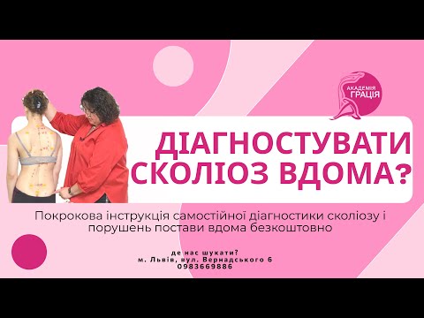 Видео: Діагностика СКОЛІОЗУ самостійно вдома // Поради реабілітолога Оксани Слінько