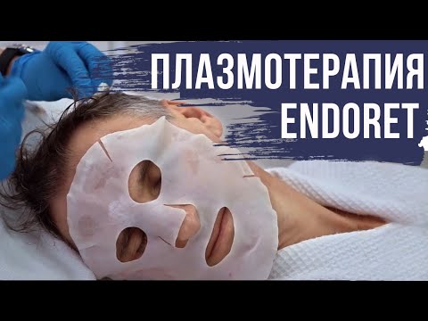 Видео: Моя Beauty-процедура: Плазматерапия Эндорет