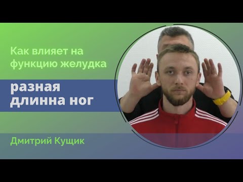 Видео: Осмотр пациента с разной длиной ног. Кинезиологические тесты. Дмитрий Кущик