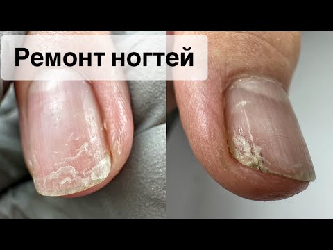 Видео: МАНИКЮР ОНЛАЙН. ГЕЛЕВЫЕ ТИПСЫ. ОПИЛ ЧЕТКОГО КВАДРАТА. Виктория Авдеева