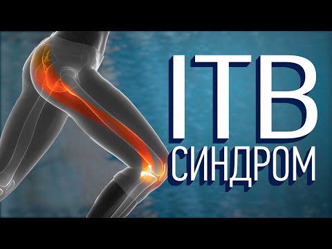Видео: Синдром илиотибиального тракта (ITBS) Как его лечить?