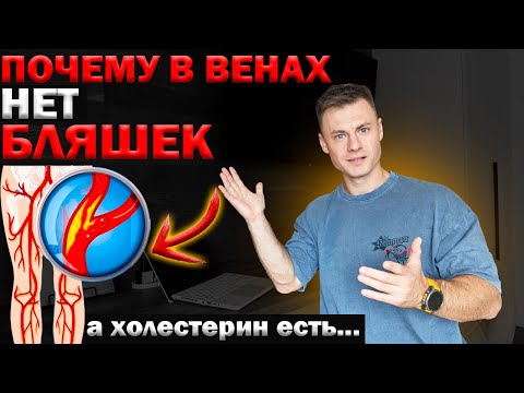 Видео: Почему в венах НЕТ бляшек...а холестерин есть?