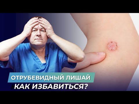 Видео: Как вылечить отрубевидный лишай?