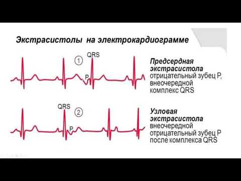 Видео: Пак Н.Л. "ЭКГ. Нарушения ритма сердца" (23.10.2023)