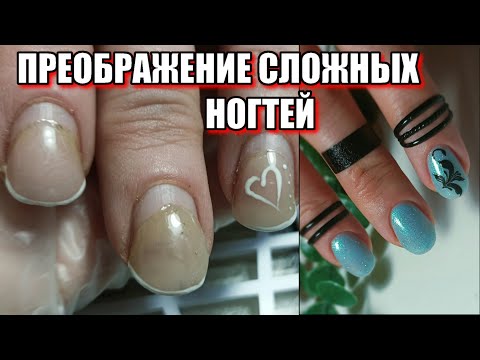 Видео: СЛОЖНЫЕ НОГТИ-ТРАПЕЦИИ / НОВЫЙ КЛИЕНТ / МАНИКЮР на клиенте / КОРРЕКЦИЯ ногтей