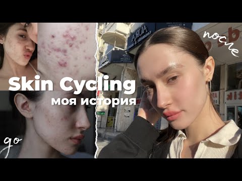 Видео: КАК Я ИЗБАВИЛАСЬ ОТ ПРЫЩЕЙ ЗА МЕСЯЦ | Skin Cycling